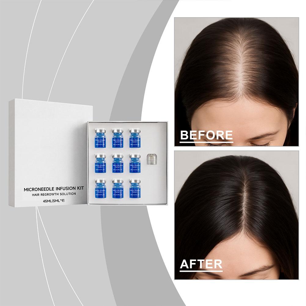 0.25 ミリメートルヘアエッセンシャルセラムマイクロニード - Hair Care Lotion のレビューと価格